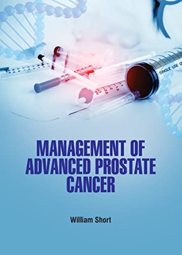 

general-books/general/management-of-advanced-prostate-cancer-hb--9781644351369