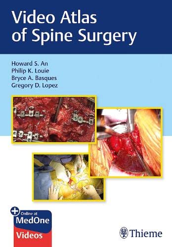 

exclusive-publishers/thieme-medical-publishers/video-atlas-of-spine-surgery--9781684200054