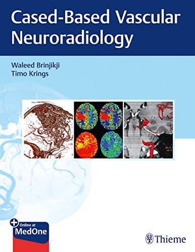 

exclusive-publishers/thieme-medical-publishers/imaging-in-neurovascular-diseases--9781684200535