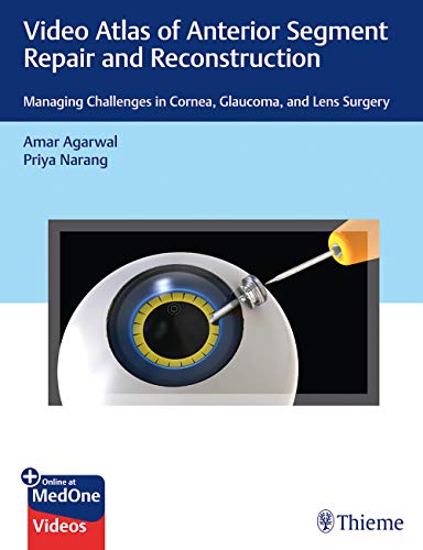 

exclusive-publishers/thieme-medical-publishers/video-atlas-of-anterior-segment-repair-and-reconstruction--9781684200979