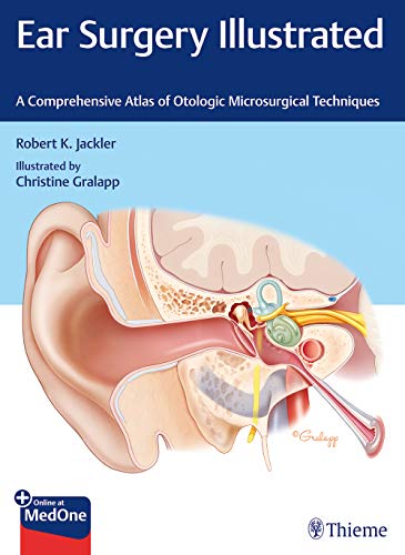 

exclusive-publishers/thieme-medical-publishers/ear-surgery-illustrated--9781684201105