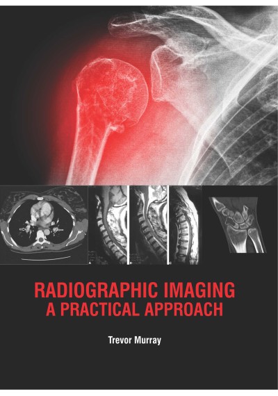 

clinical-sciences/radiology/radiographic-imaging-a-practical-approach-9781788824309