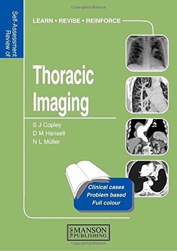 

general-books/general/thoracic-imaging-self-assessment-colour-review--9781840760620