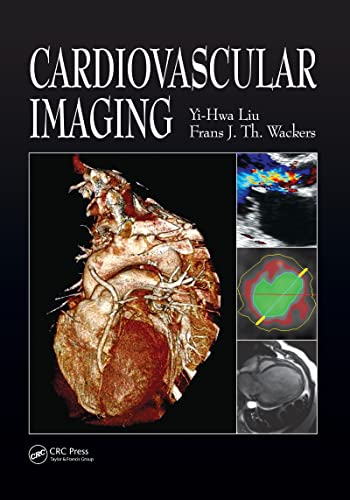

exclusive-publishers/thieme-medical-publishers/cardiovascular-imaging-9781840761092