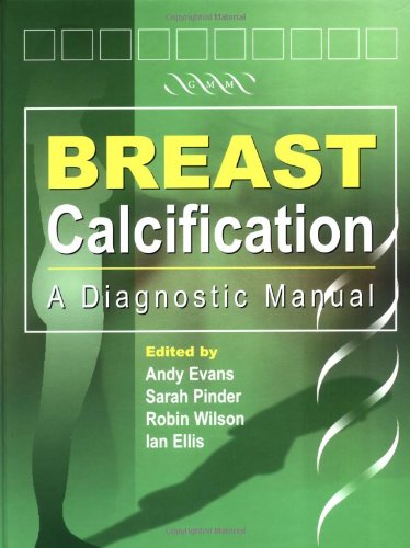 BREAST CALCIFICATION A DIAGNOSTIC MANUAL