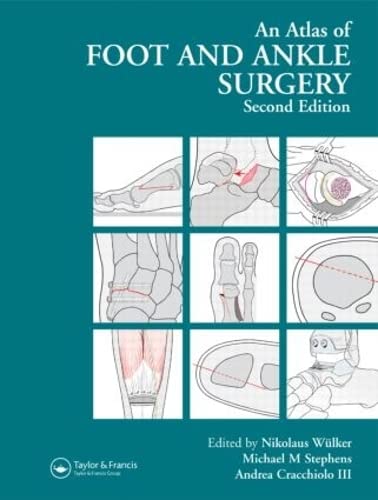 

general-books/general/atlas-foot-and-ankle-surgery-second-edition--9781841841953