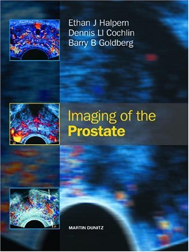 

special-offer/special-offer/imaging-of-the-prostate--9781841841984