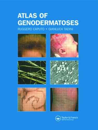 

mbbs/3-year/atlas-of-genodermatoses-9781841842516