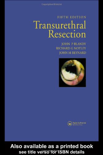 

general-books/general/transurethral-resection-5-ed--9781841844084
