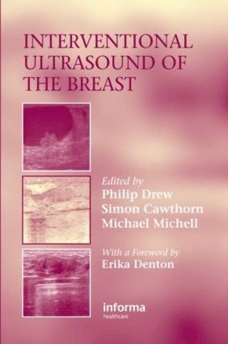 

mbbs/4-year/interventional-ultrasound-of-the-breast-9781841844169
