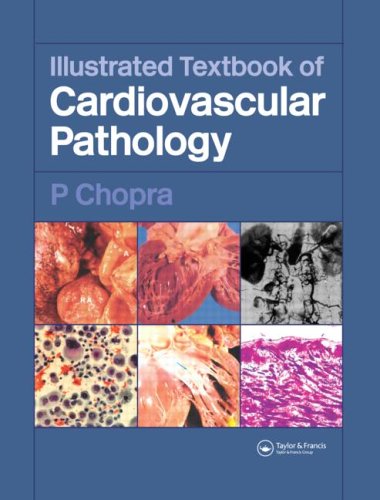 

mbbs/3-year/illustrated-textbook-of-cardiovascular-pathology-9781841844510