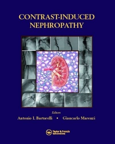 

clinical-sciences/cardiology/contrast-induced-nephropathy-in-interventional-cardiovascular-medicine-9781841845623