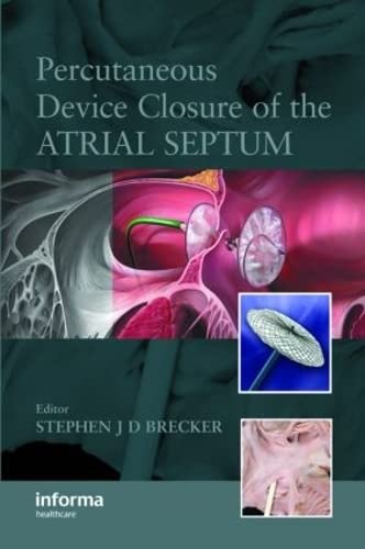 

clinical-sciences/cardiology/percutaneous-device-closure-of-the-artial-septum-9781841845968