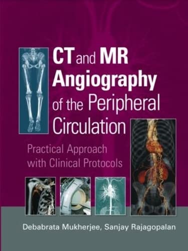 

mbbs/4-year/ct-and-mr-angiography-of-the-peripheral-circulation-9781841846064