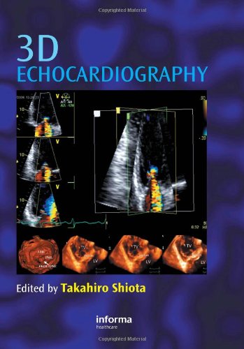 

clinical-sciences/cardiology/3d-echocardiography-9781841846323