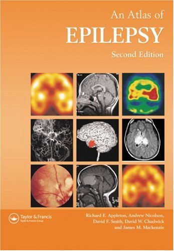 

general-books/general/atlas-of-epilepsy-2ed--9781842140277