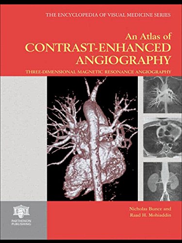 

clinical-sciences/cardiology/an-atlas-of-contrast-enhanced-angiography-three-dimensional-magnetic-resonance-angiography-9781842140819