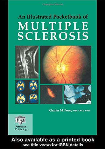 

special-offer/special-offer/an-illustrated-pocketbook-of-multiple-sclerosis--9781842141410