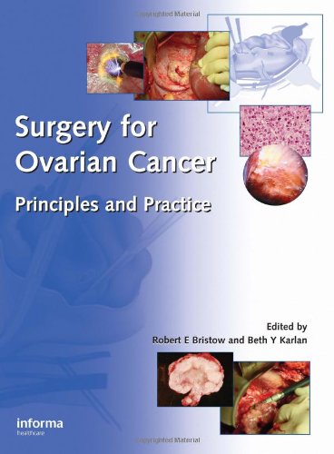 

mbbs/4-year/surgery-for-ovsarian-cancer-priciples-and-practice-9781842141656