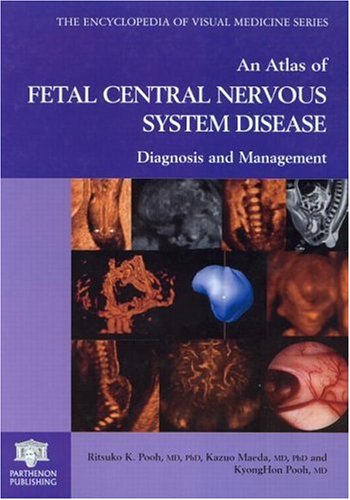 

surgical-sciences/obstetrics-and-gynecology/an-atlas-of-fetal-central-nervous-system-disease-9781842142028