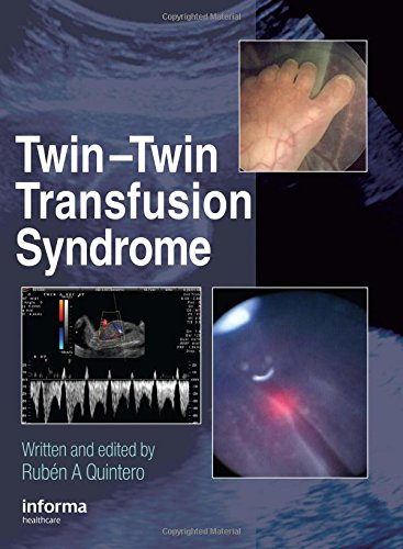 

exclusive-publishers/taylor-and-francis/twin-twin-transfusion-syndrome--9781842142981
