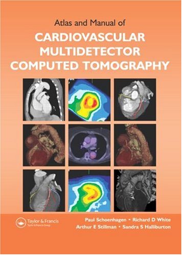 

clinical-sciences/cardiology/atlas-and-manual-of-cardiovascular-multidetector-computed-tomography-9781842143025