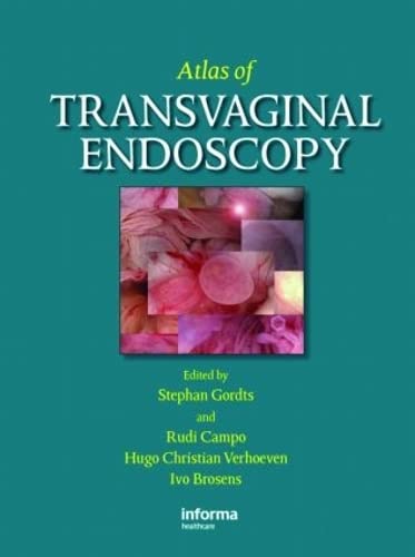 

surgical-sciences/obstetrics-and-gynecology/atlas-of-transvaginal-endoscopy-9781842143209