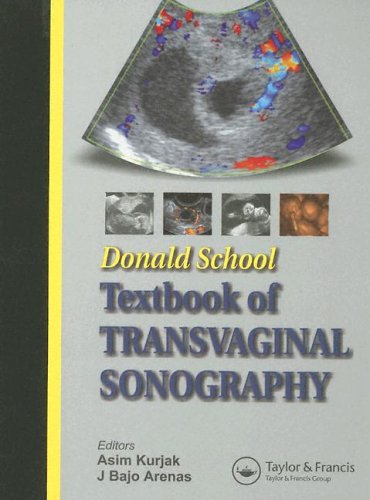 

general-books/general/donald-school-textbook-of-transvaginal-sonography-1-ed--9781842143315