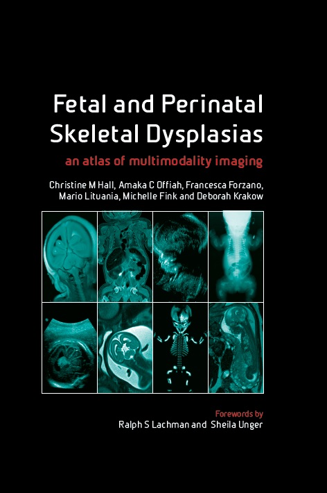 

mbbs/4-year/fetal-and-perinatal-sketal-dysplasias--9781846194887