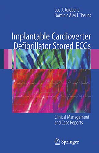 

clinical-sciences/cardiology/implantable-cardioverter-defibrillator-stored-ecgs-clinical-management-and-case-reports-9781846286797