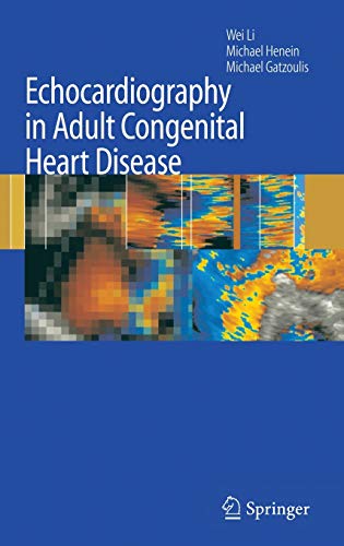 

exclusive-publishers/springer/echocardiography-in-adult-congenital-heart-disease--9781846288159