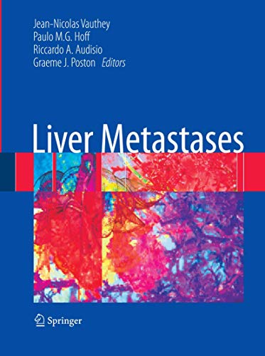 

clinical-sciences/gastroenterology/liver-metastases-9781846289460