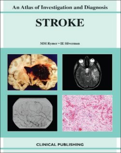 

general-books/general/an-atlas-of-investigation-and-treatment-ischemic-stroke-1-ed--9781846920172