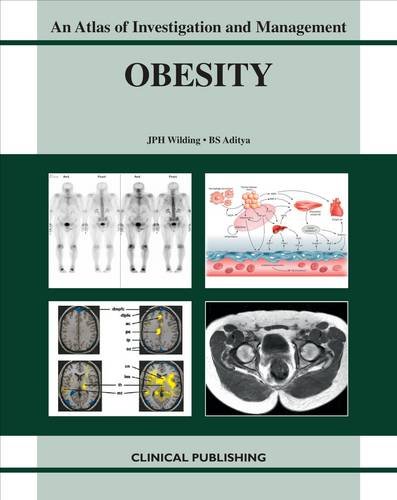 

general-books/general/obesity-an-atlas-of-investigation-and-management-1-ed--9781846920271