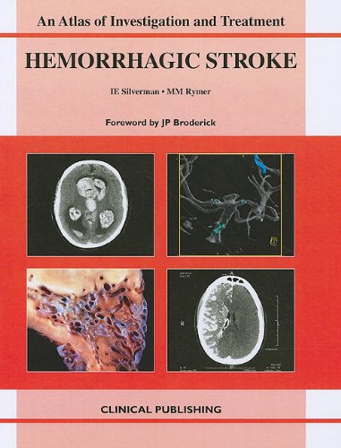 

general-books/general/an-atlas-of-investigation-and-treatment-hemorrhagic-stroke-1-ed--9781846920394