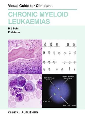 

mbbs/4-year/visual-guide-for-clinicians-chronic-myeloid-leukaemias-9781846920943