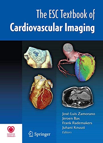 

special-offer/special-offer/the-esc-textbook-of-cardiovascular-imaging--9781848824201