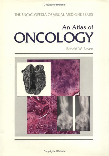 

general-books/general/an-atlas-of-oncology-encyclopedia-of-visual-medicine-series--9781850703631