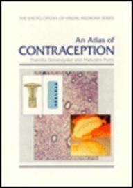 

special-offer/special-offer/an-atlas-of-contraception-the-encyclopedia-of-visual-medicine-series--9781850703877