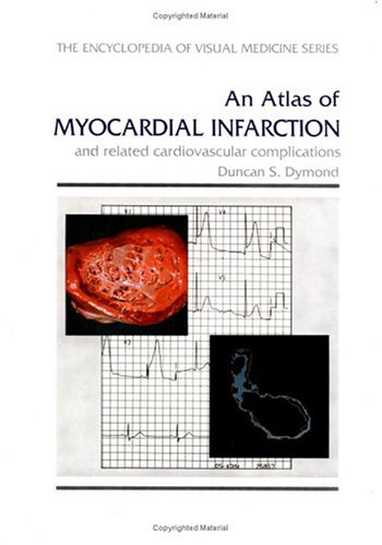 

special-offer/special-offer/an-atlas-of-myocardial-infarction-and-related-cardiovascular-complications--9781850705055