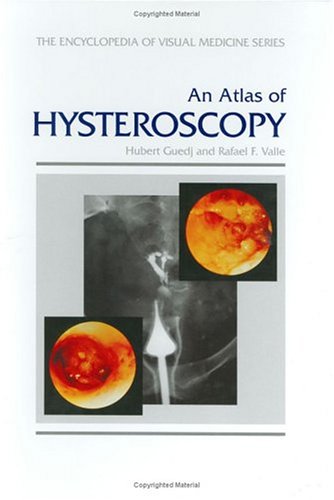 

surgical-sciences/obstetrics-and-gynecology/an-atlas-of-hysteroscopy-9781850705062