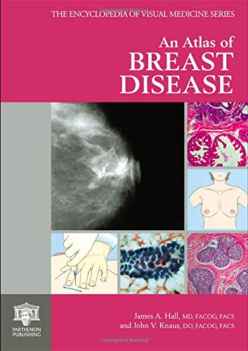 

surgical-sciences/oncology/an-atlas-of-breast-disease-9781850705338