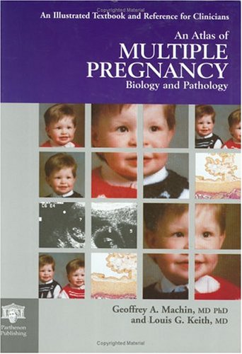 

special-offer/special-offer/an-atlas-of-multiple-pregnancy-biology-and-pathology-international-congr--9781850709183