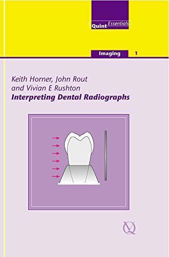 

dental-sciences/dentistry/interpreting-dental-radiographs-quint-essentials-imaging--9781850970521