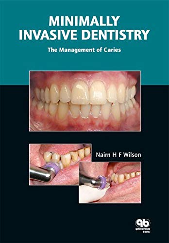 

dental-sciences/dentistry/minimally-invasive-dentistry-the-management-of-caries-1-ed--9781850971054