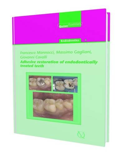 

dental-sciences/dentistry/adhesive-restoration-of-endodontically-treated-teeth-quint-essentials-40-9781850971351