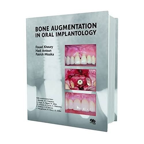 

general-books/general/bone-augmentation-in-oral-implantology--9781850971597