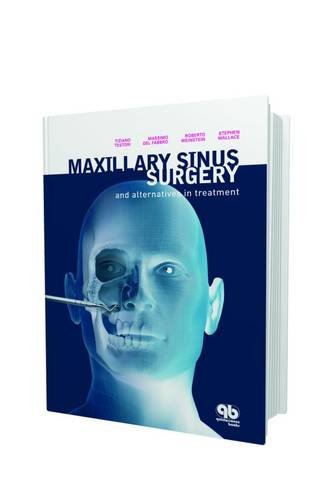 

dental-sciences/dentistry/maxillary-sinus-surgery-and-alternatives-in-treatment--9781850971702