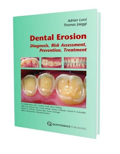 

dental-sciences/dentistry/dental-erosion-diagnosis-risk-assessment-prevention-treatment-9781850972181