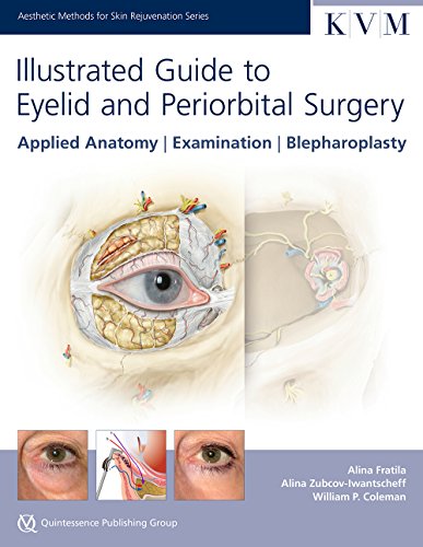 

mbbs/3-year/illustrated-guide-to-eyelid-and-periorbital-surgery-applied-anatomy-examination-blepharoplasty-9781850972723